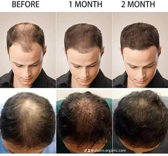 475044618_122136785150487641_6082706065176718447_n