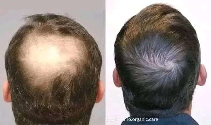 475876010_122136785120487641_3922006609608901767_n