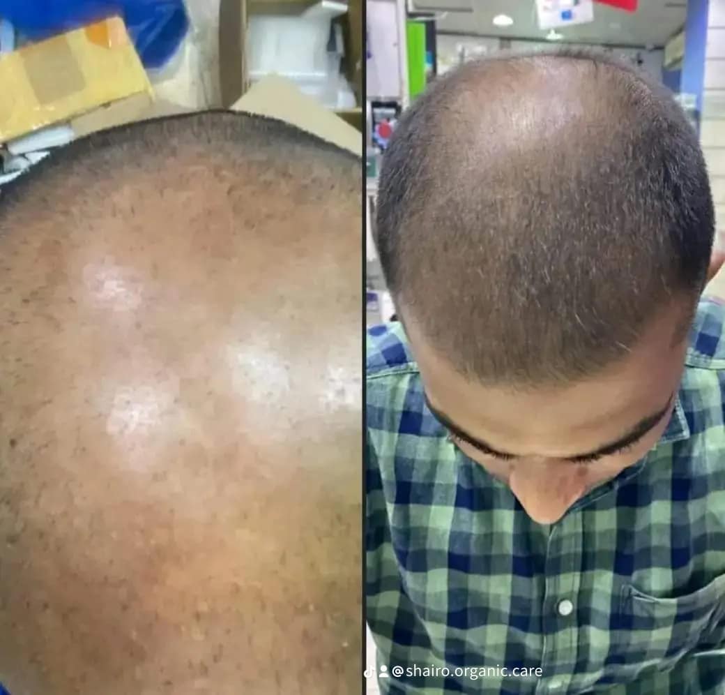 476362376_122136785270487641_8962834781974337601_n